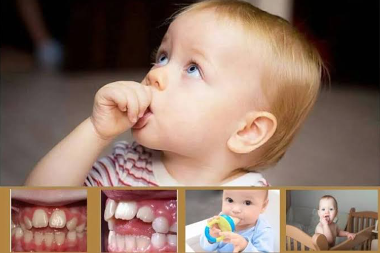 استفاده از پستانک بعد از 2 سالگی می تواند باعث مشکلات دندانی در کودک شود.